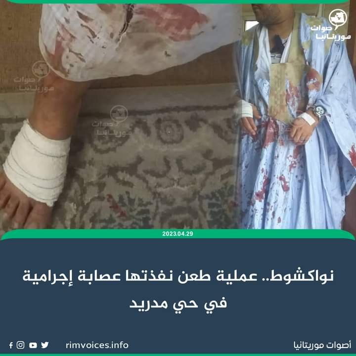نواكشوط :عملية طعن نفذتها عصابة اجرامية ضد تاجر موريتاني بحي مادريد